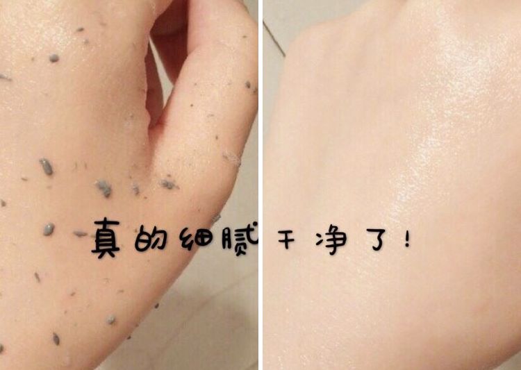 柔嫩抛光|脸上搓出3斤泥!难怪又黄又暗又黑头!10秒给脸蛋“剥壳”,厉害