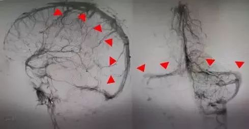 26岁小伙熬夜加班,26岁小伙熬夜头晕