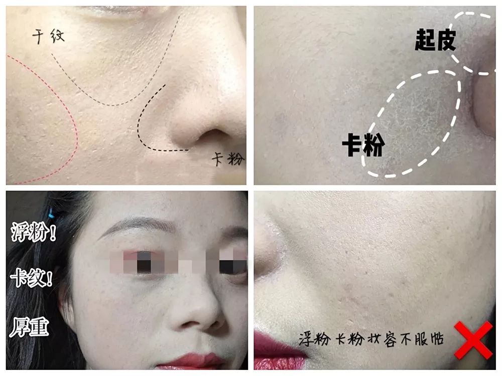 卡粉起皮怎么补救没有面霜和水乳,卡粉起皮怎么补救油皮