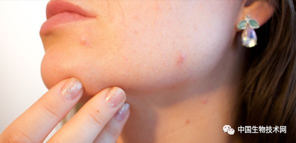 Science子刊:为什么一些护肤品会引起皮炎?