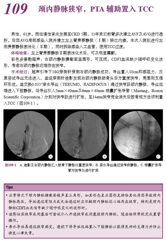 血液透析全套书,血液透析血管通路书籍推荐