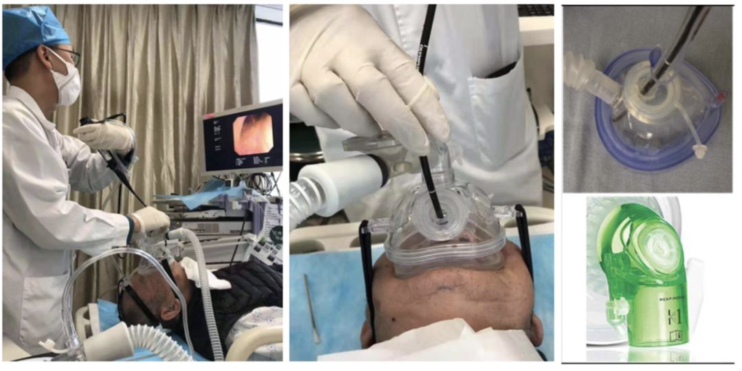 新型冠状病毒重症病例的治疗原则,新型冠状病毒危重治疗原则是什么