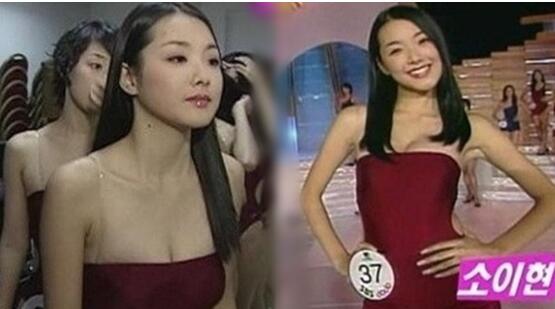 韩国明星谈整容,韩国明星整容失败