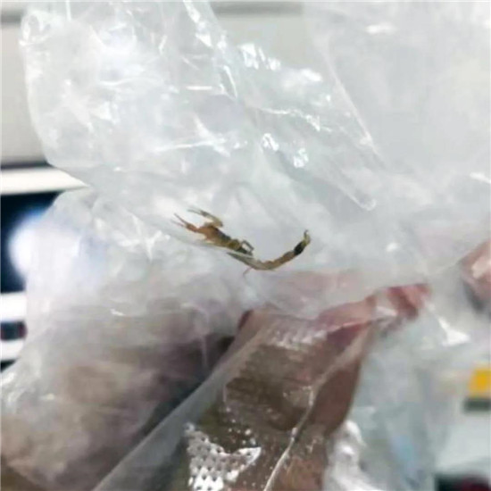 惊险！唐山妇幼耳鼻喉科一天收治7例异物患者