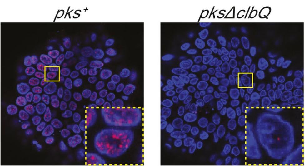 《自然》：20%的人肠道中都有的这个菌，竟会导致DNA断裂！科学家首次破解基因毒性大肠杆菌致癌的两种基因突变特征丨科学大发现