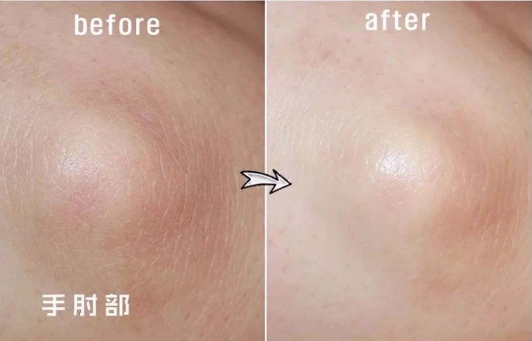 美脚神器哪个效果最好,美脚神器去角质呵护足底