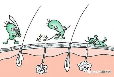 老中医特效药配方,老中医常用特效药