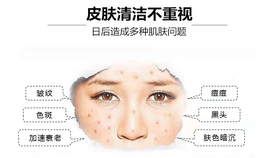 珊苏丽祛痘洁面皂,姗苏丽果酸洁面皂