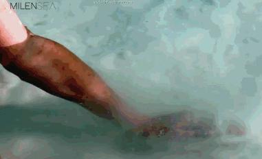 前胸鸡皮痘痘怎么处理,胸背痘痘清理