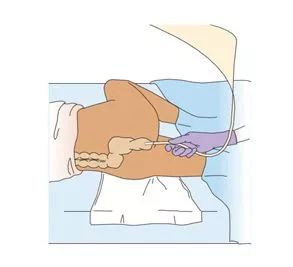 关于灌肠，这是我看过最有趣的科普