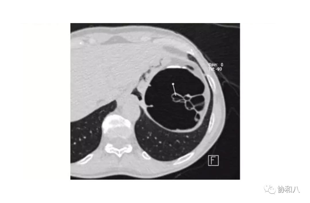 复习这些名解时总觉得怪饿的|协和八·脑洞大开