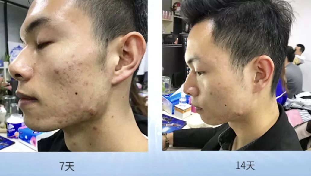 澳洲清爽保湿修复面霜,新西兰蜂蜜麦卢卡面霜