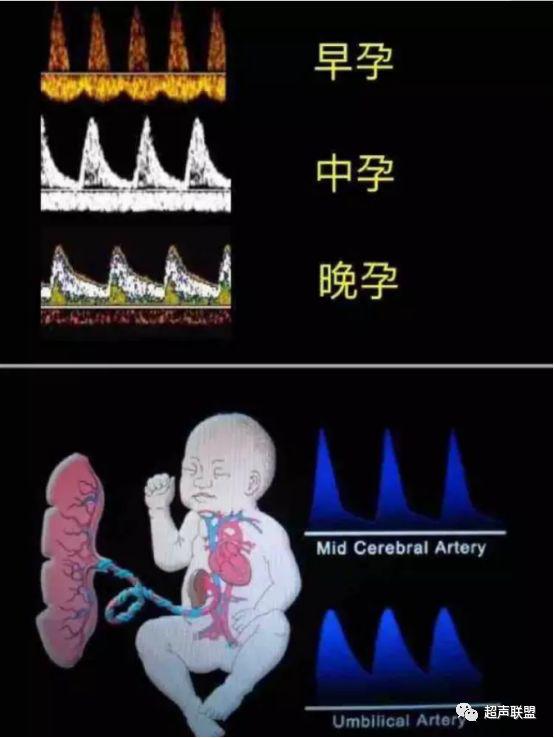 胎儿宫内窘迫通过什么检查出来的,胎儿宫内缺氧的超声视频