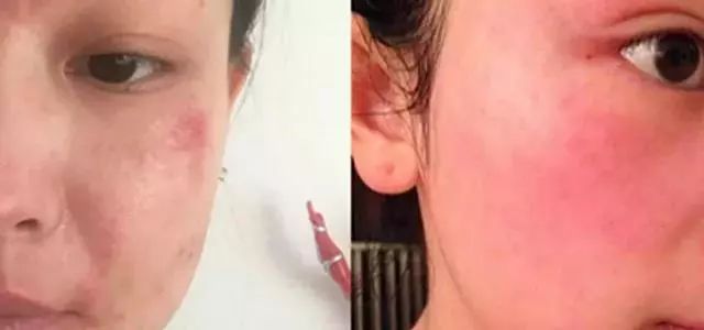 20天白到发亮,15天快速美白