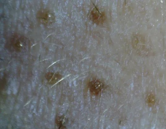 洗出脸上的脏东西解压,清除脸上斑块的产品