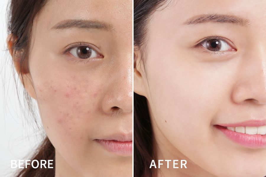 海蓝之谜lamer全新精华凝霜清爽型,lamer海蓝之谜眼霜礼盒