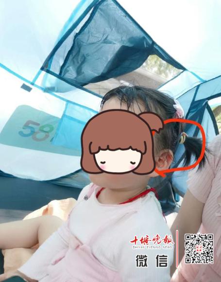 寻找人工耳蜗4岁男童,郑州4岁女童人工耳蜗