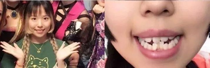 昆明独生子父母可以领补贴吗,昆明怎么领取补贴