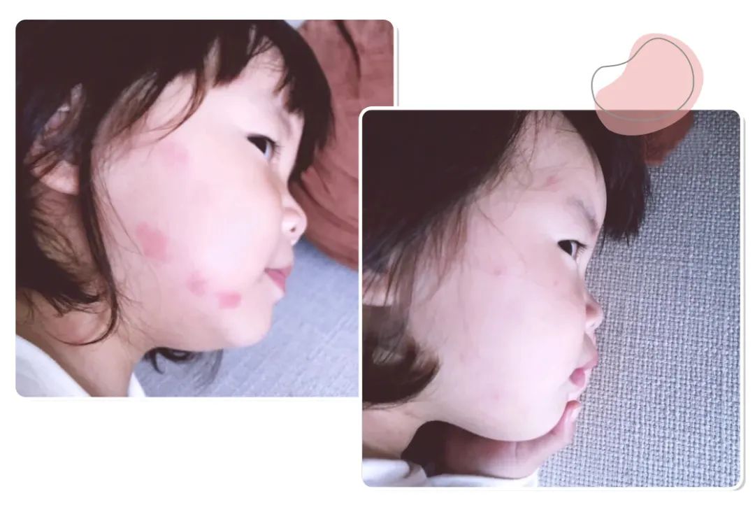 喷花露水驱蚊止痒,黄圣依代言的保湿防晒喷雾