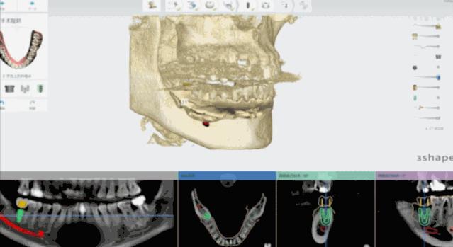 517吃货节来袭！缺它吃不快乐！千元补贴快领