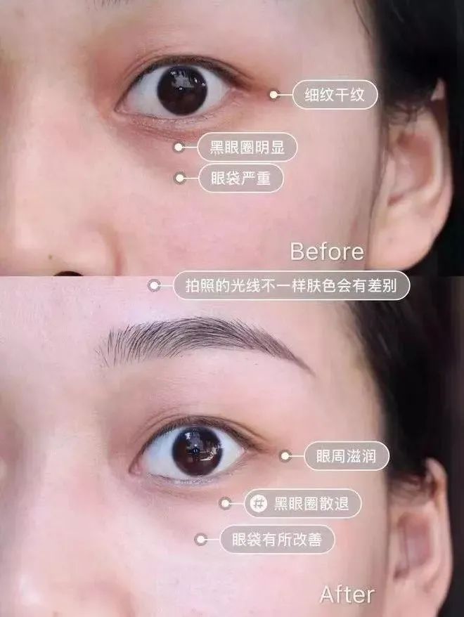 长期补充胶原蛋白的人怎么样了,长期喝胶原蛋白的人最后怎么样了