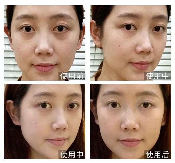 眼霜中的爱马仕!清爽不长脂肪粒,去黑眼圈效果秒2000元腊梅,亲测有效