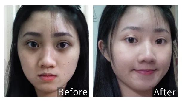 眼霜中的爱马仕!清爽不长脂肪粒,去黑眼圈效果秒2000元腊梅,亲测有效