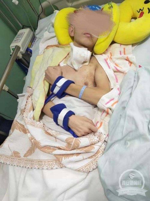 昏迷200余天植物人有望苏醒，西北首例VNS手术成功实施