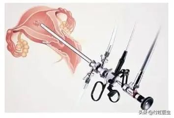 B超检查“子宫内膜回声不均”，我到底得了什么病？