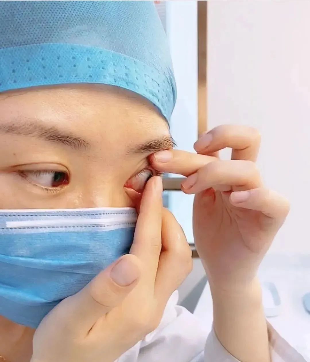 眼科医生能帮忙摘隐形眼镜吗,隐形眼镜可以徒手摘吗
