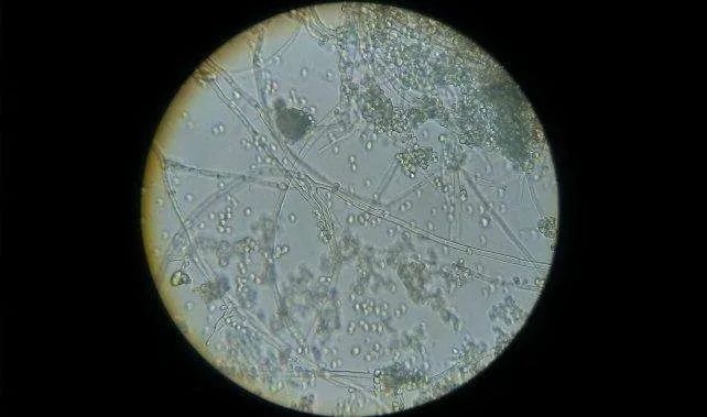 杭州今日入梅，梅雨季节居家除霉妙招请收好