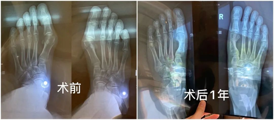 做完医美真的能换脸吗,做完医美需要注意什么