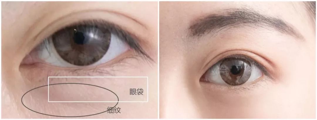 超微小气泡毛孔吸尘器使用方法,毛孔吸尘器去黑头收缩毛孔