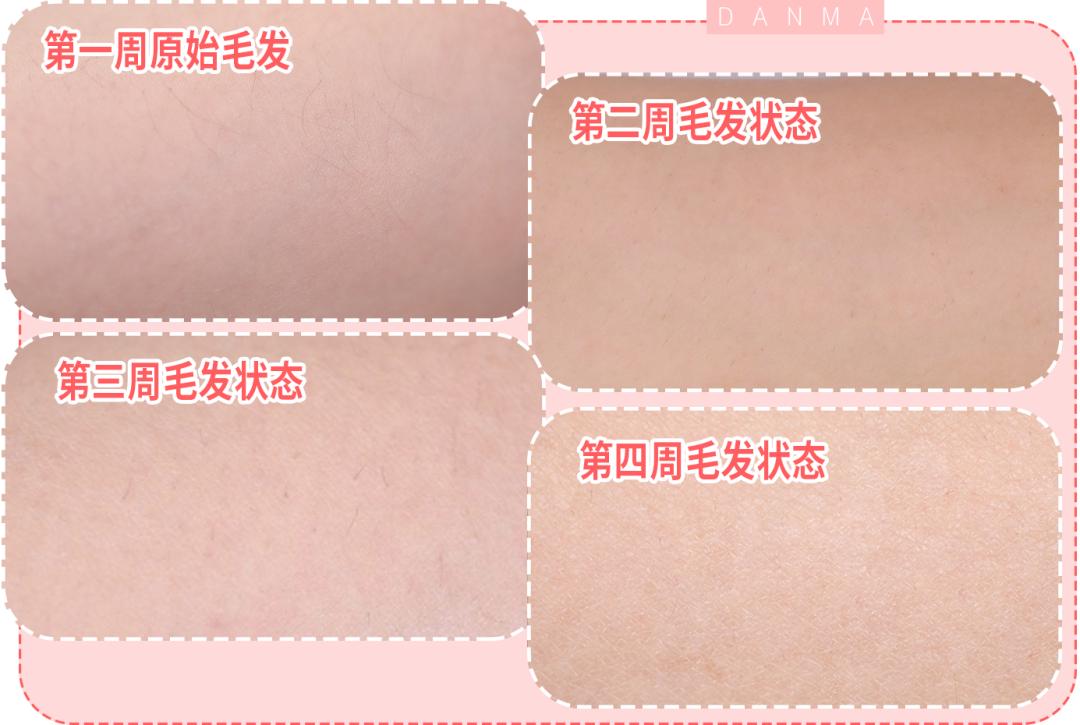 超良心真人测评！花了28天，告诉你脱毛仪到底值不值得买|辣妈研究所065