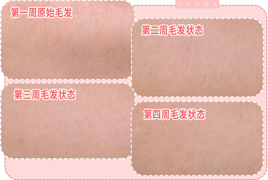 超良心真人测评！花了28天，告诉你脱毛仪到底值不值得买|辣妈研究所065