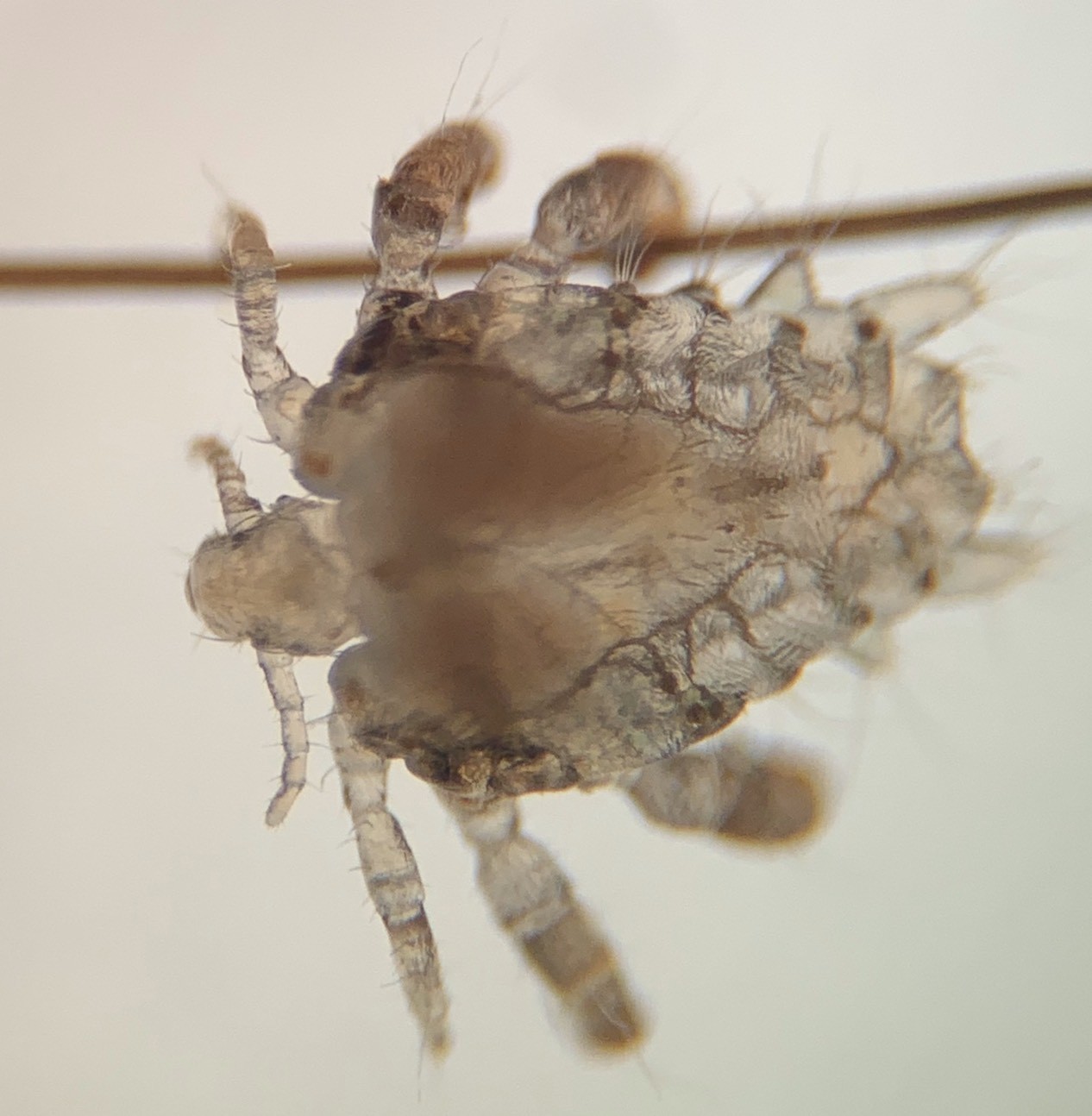 6脚恶虫*体下**钻动痒爆！医揭治疗4招：30%会出现其他性病