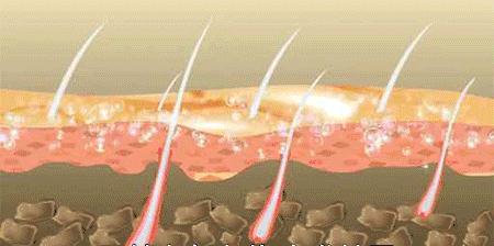 显白发色黄皮夏天,夏天适合染什么发色高级显白