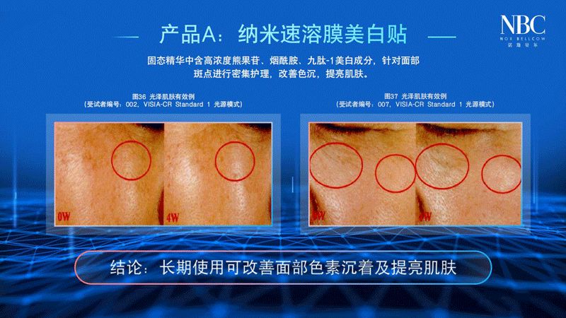 诺斯贝尔面膜怎样,诺斯贝尔的面膜怎么样