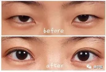 爱美小窍门有哪些,爱美小技巧女生