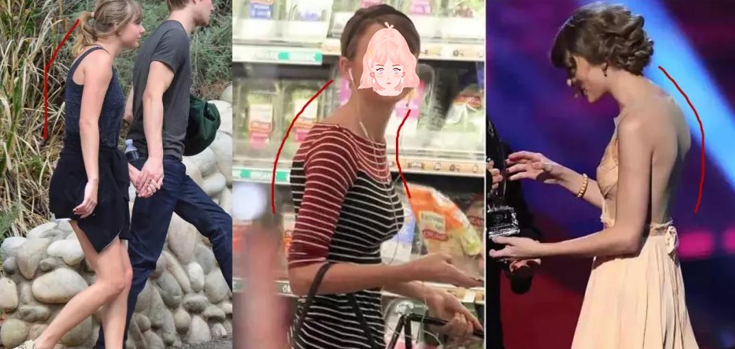 有什么方法可以改善含胸驼背,含胸驼背改善的方法