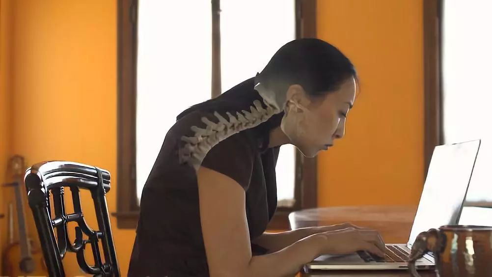 有什么方法可以改善含胸驼背,含胸驼背改善的方法