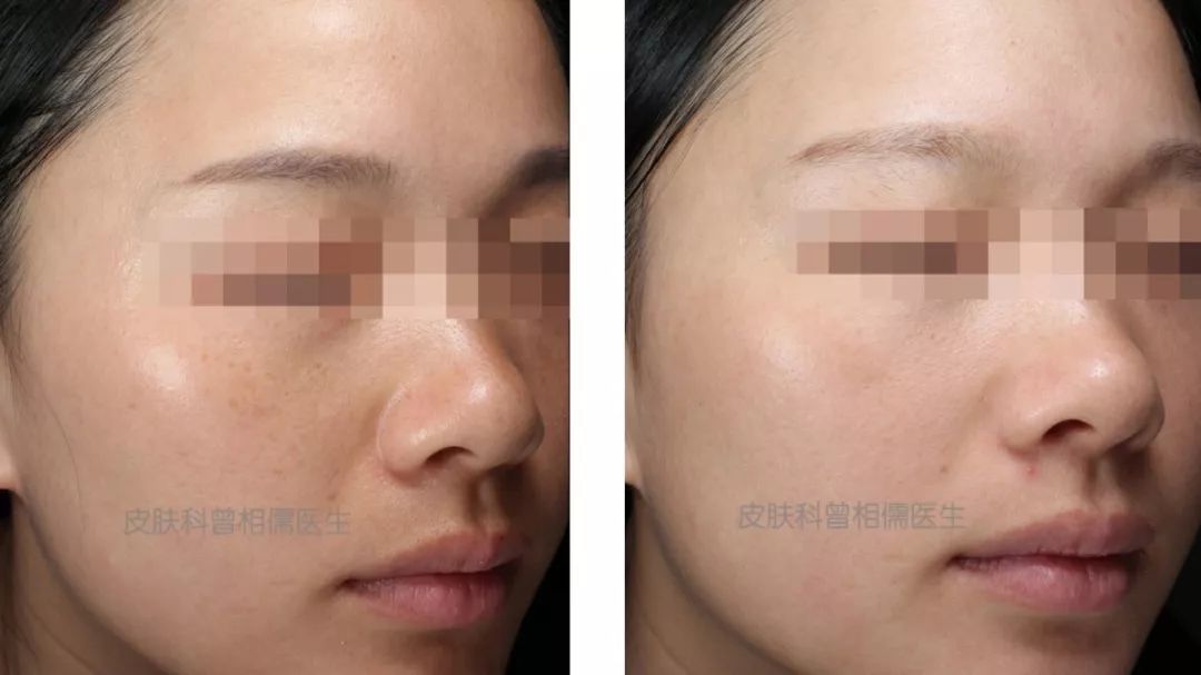 坚持美白才能白吗,坚持全身美白的方法