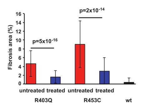 肥厚型心肌病特效新药强势来临：Mavacamten的前世、今生和未来｜安贞心语