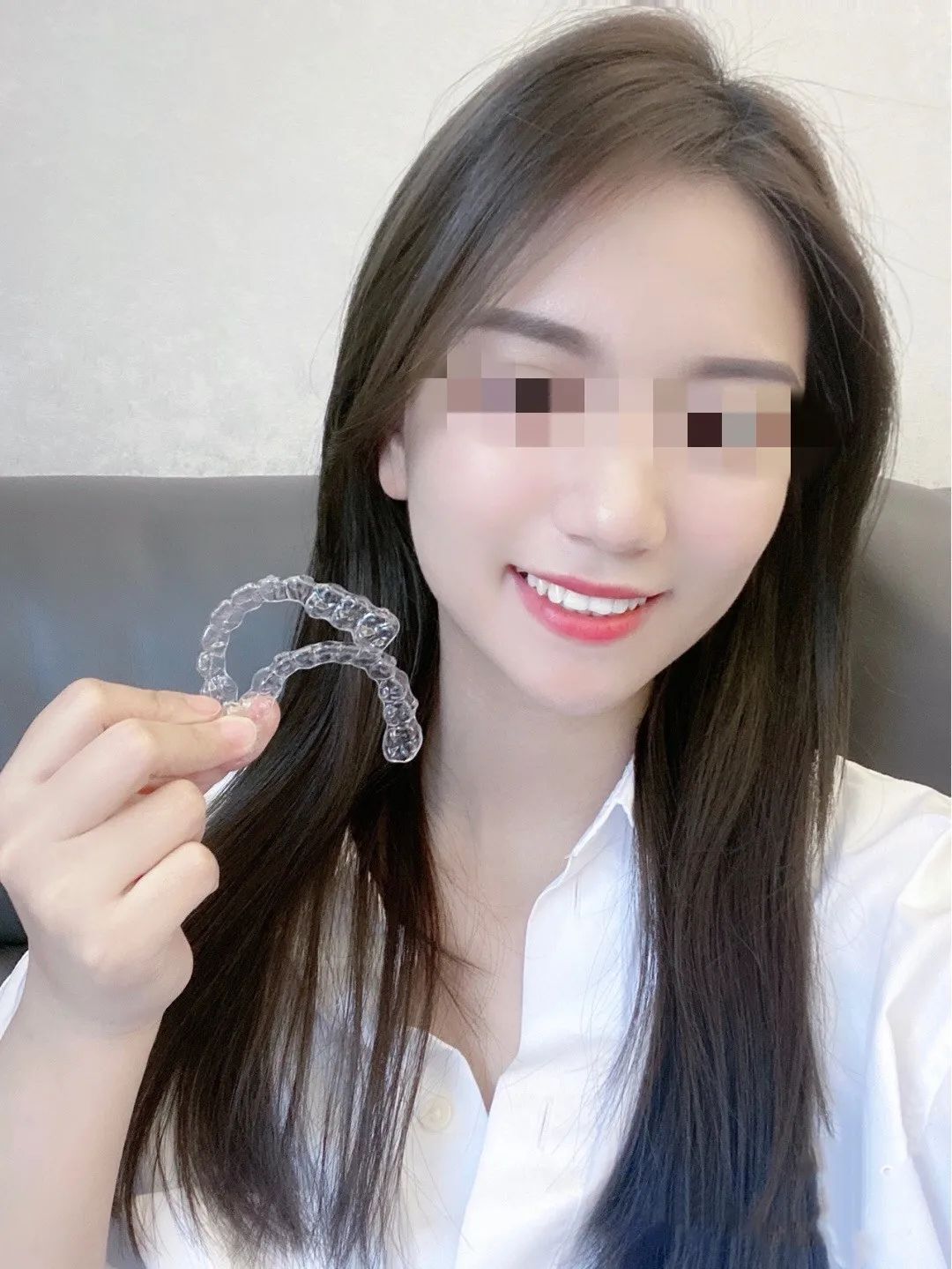 昆明龅牙矫正哪家便宜,长沙成人隐形牙齿矫正龅牙