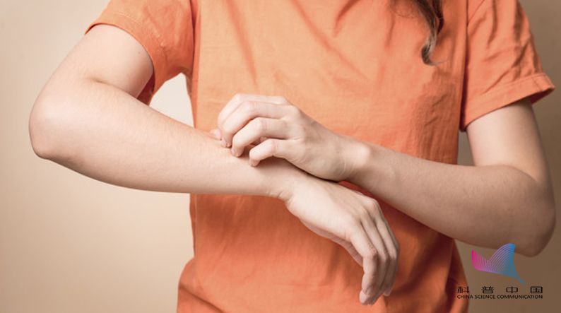 蚊子包挠多久会止痒,被蚊子咬了特别痒怎么快速止痒