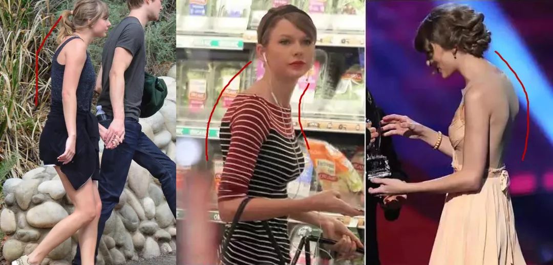 驼背平时自己注意可以改善吗,驼背如何矫正自己的气质