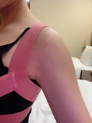 驼背平时自己注意可以改善吗,驼背如何矫正自己的气质