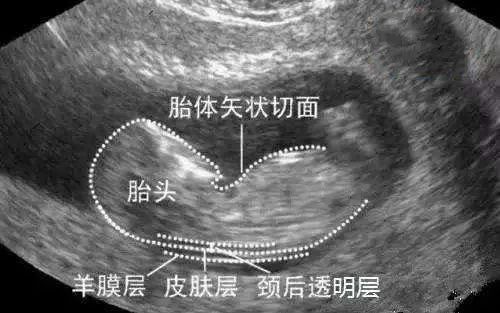 怎样读懂多普勒超声报告单,健康监测体检报告单