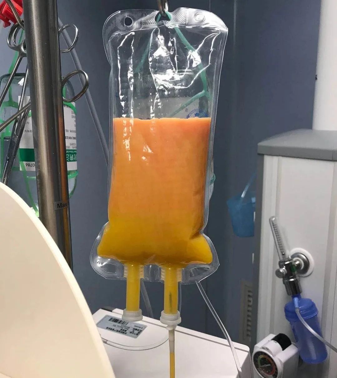 孕妇吃炸鸡2小时血糖6.5,孕早期不小心吃了隔夜的炸鸡