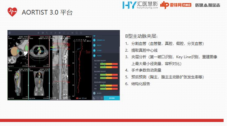 ai辅助医生心血管疾病诊断效率,ai技术治疗心血管疾病